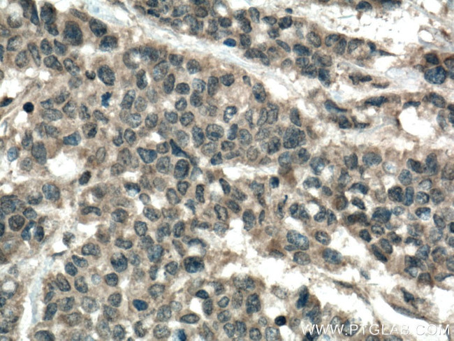 CARD11 Antibody in Immunohistochemistry (Paraffin) (IHC (P))