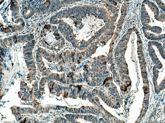 CARD11 Antibody in Immunohistochemistry (Paraffin) (IHC (P))