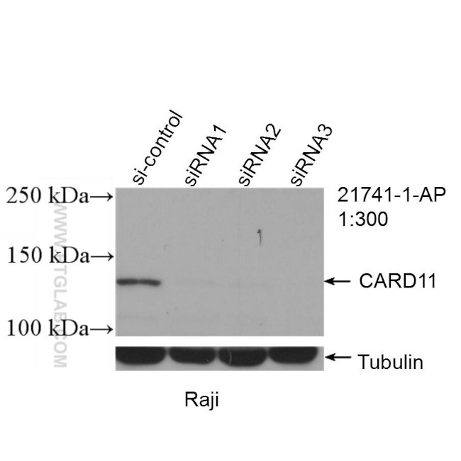 CARD11 Antibody in Western Blot (WB)