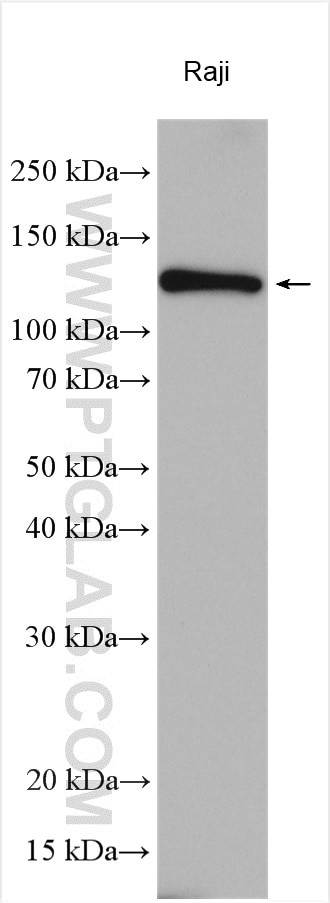 CARD11 Antibody in Western Blot (WB)