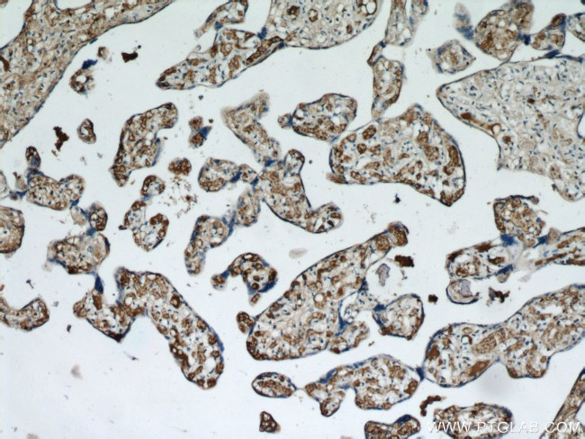 pregnancy zone protein Antibody in Immunohistochemistry (Paraffin) (IHC (P))