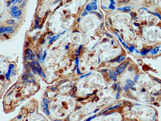 pregnancy zone protein Antibody in Immunohistochemistry (Paraffin) (IHC (P))