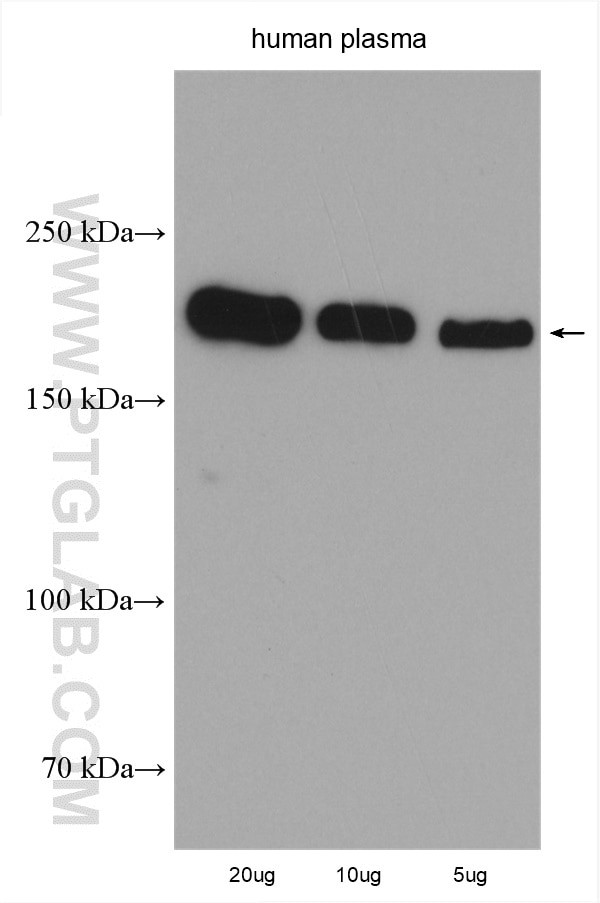 pregnancy zone protein Antibody in Western Blot (WB)