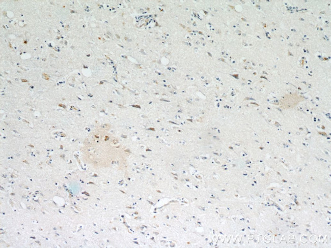 pregnancy zone protein Antibody in Immunohistochemistry (Paraffin) (IHC (P))