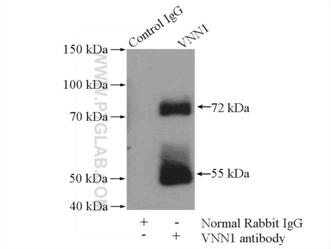 VNN1 Antibody in Immunoprecipitation (IP)