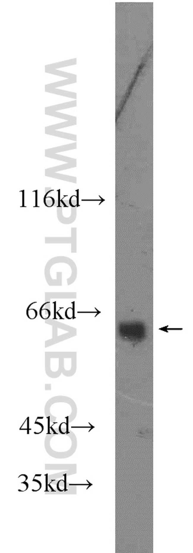 VNN1 Antibody in Western Blot (WB)