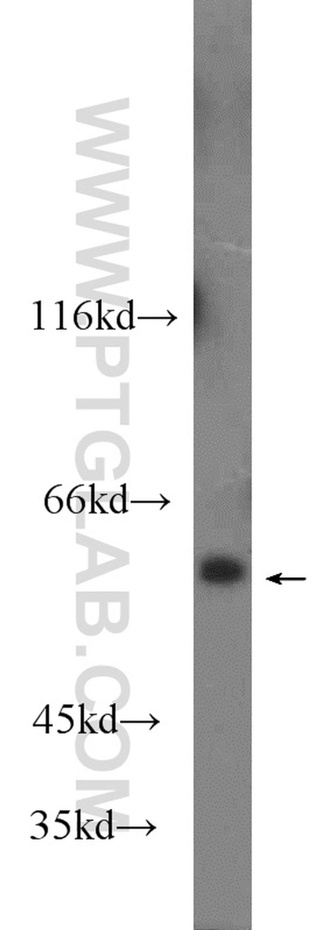 VNN1 Antibody in Western Blot (WB)