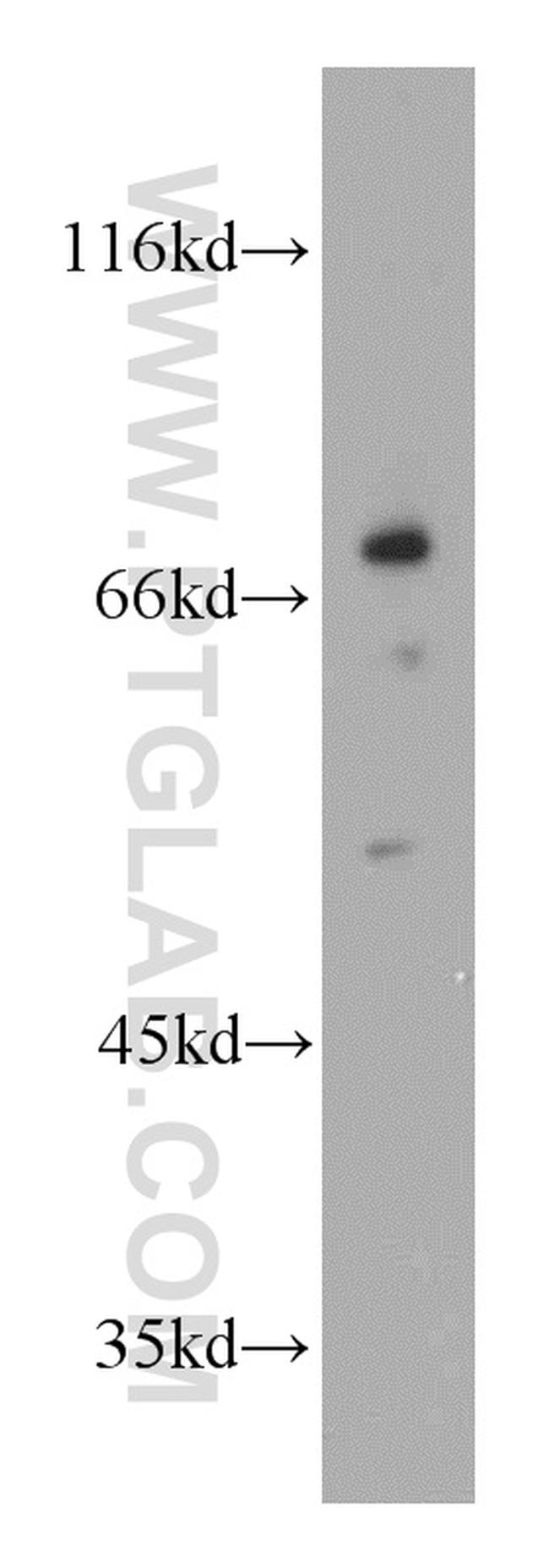 VNN1 Antibody in Western Blot (WB)