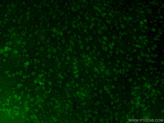 HIGD1A Antibody in Immunohistochemistry (PFA fixed) (IHC (PFA))