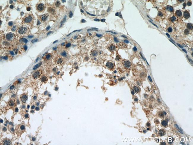 HIGD1A Antibody in Immunohistochemistry (Paraffin) (IHC (P))