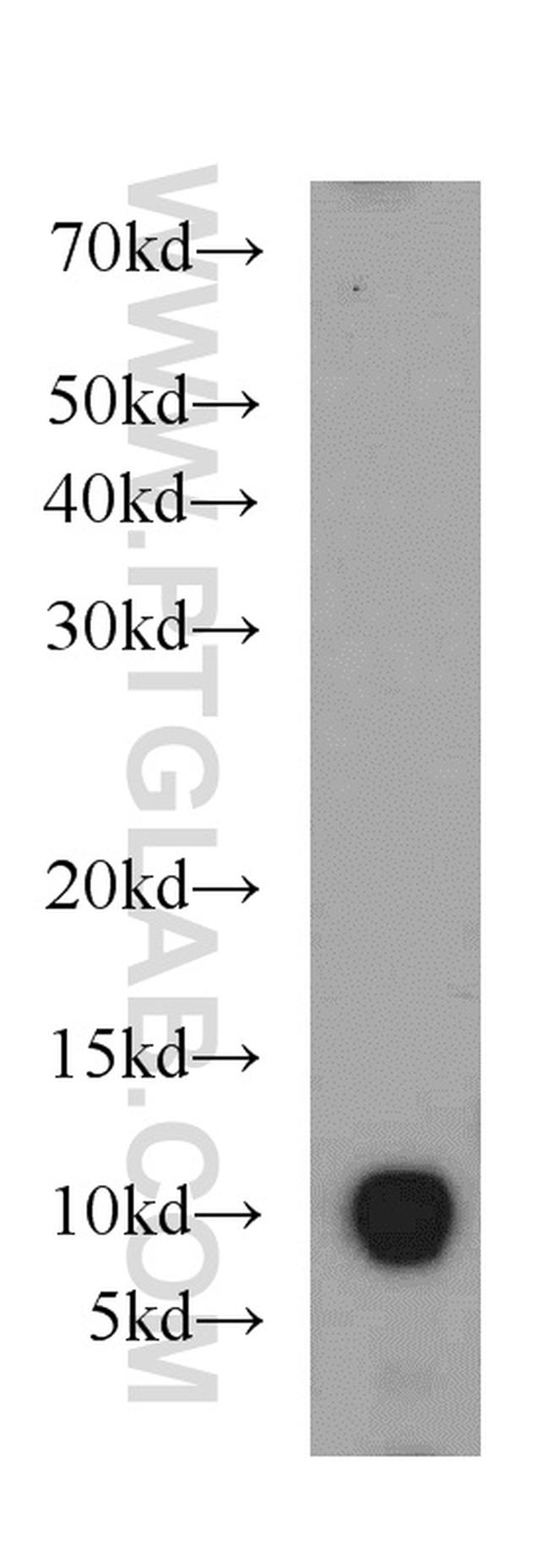 HIGD1A Antibody in Western Blot (WB)