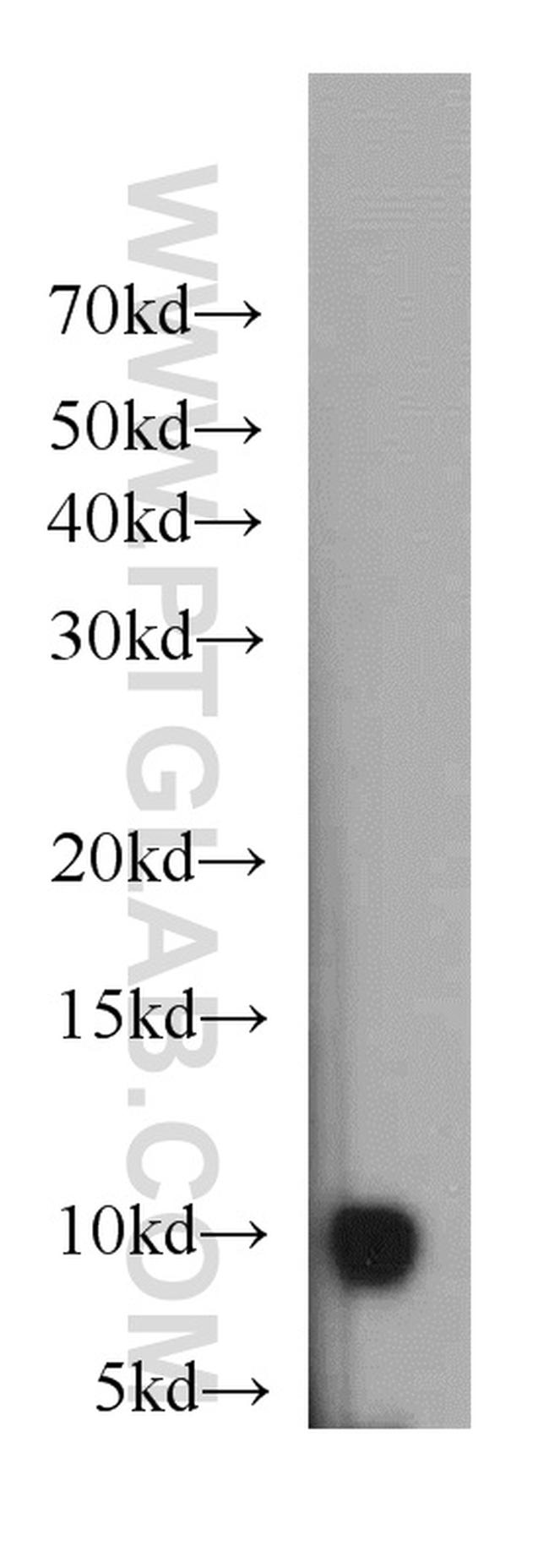 HIGD1A Antibody in Western Blot (WB)