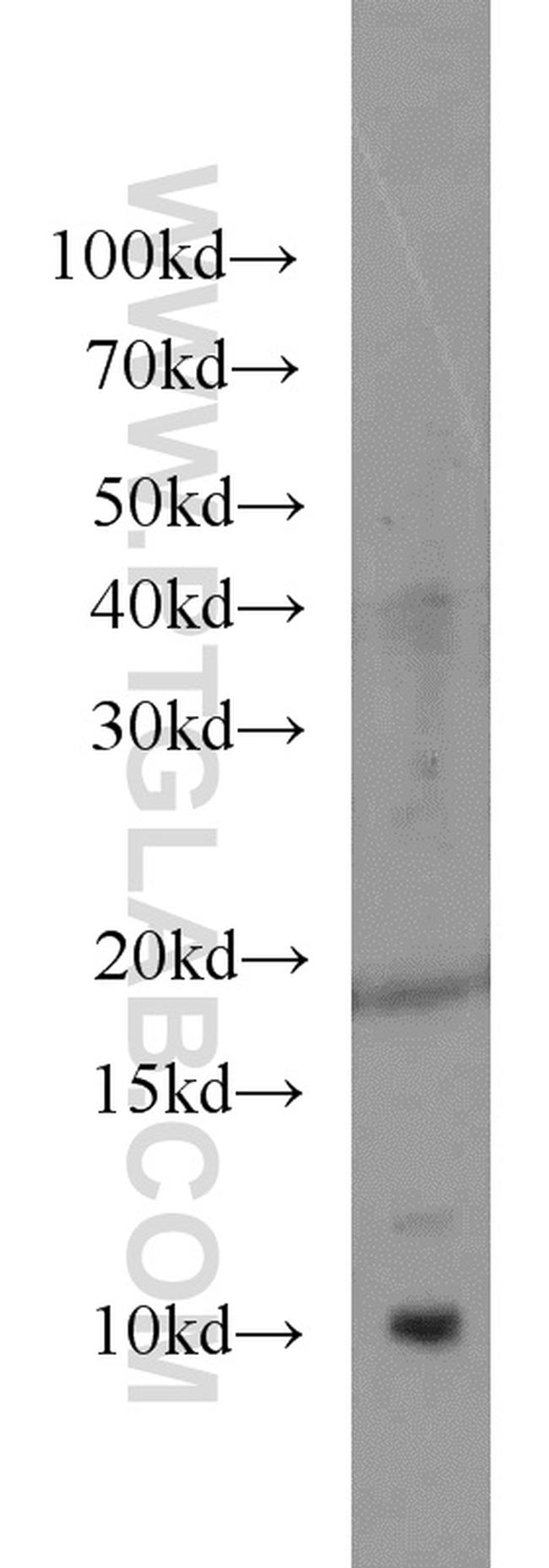 HIGD1A Antibody in Western Blot (WB)