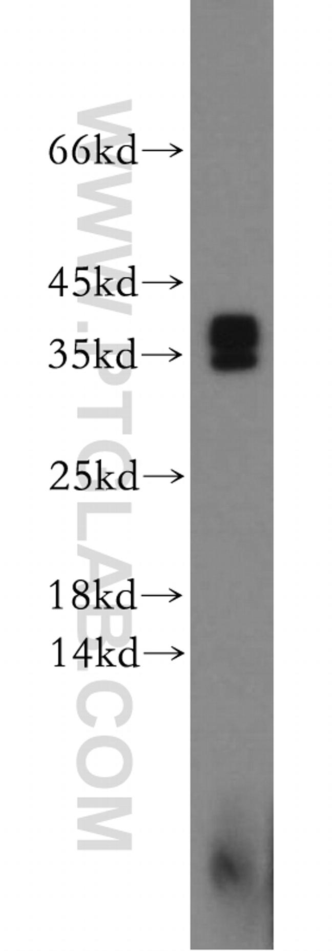 Synaptogyrin-4 Antibody in Western Blot (WB)