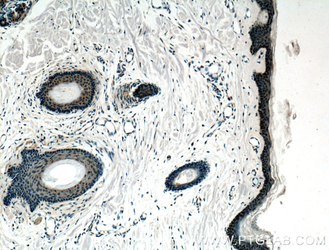 ZNF750 Antibody in Immunohistochemistry (Paraffin) (IHC (P))