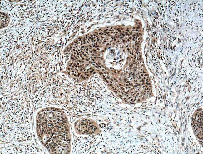 ZNF750 Antibody in Immunohistochemistry (Paraffin) (IHC (P))