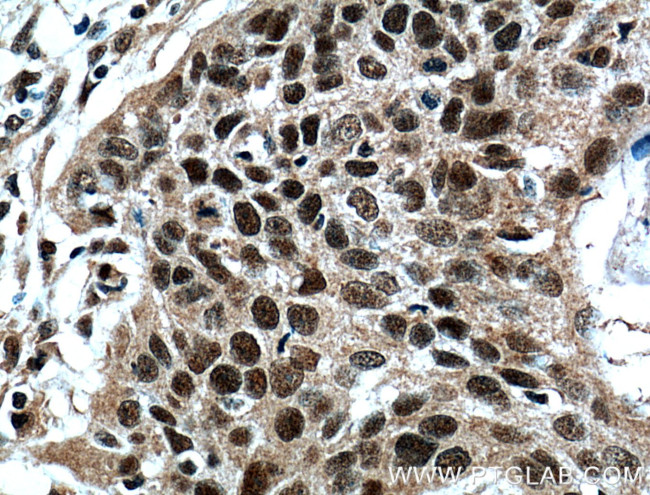 ZNF750 Antibody in Immunohistochemistry (Paraffin) (IHC (P))