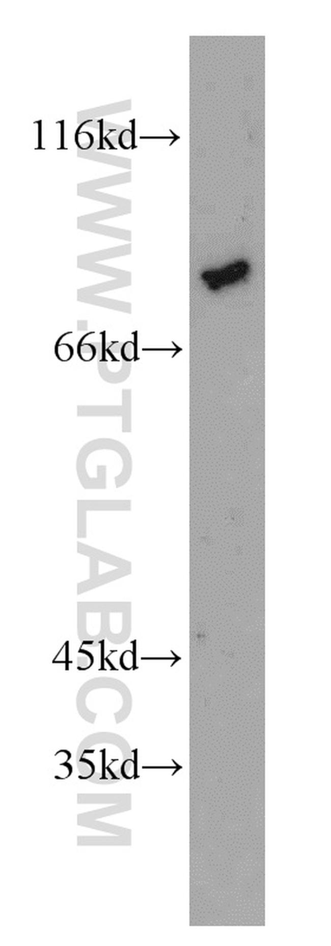 ZNF750 Antibody in Western Blot (WB)