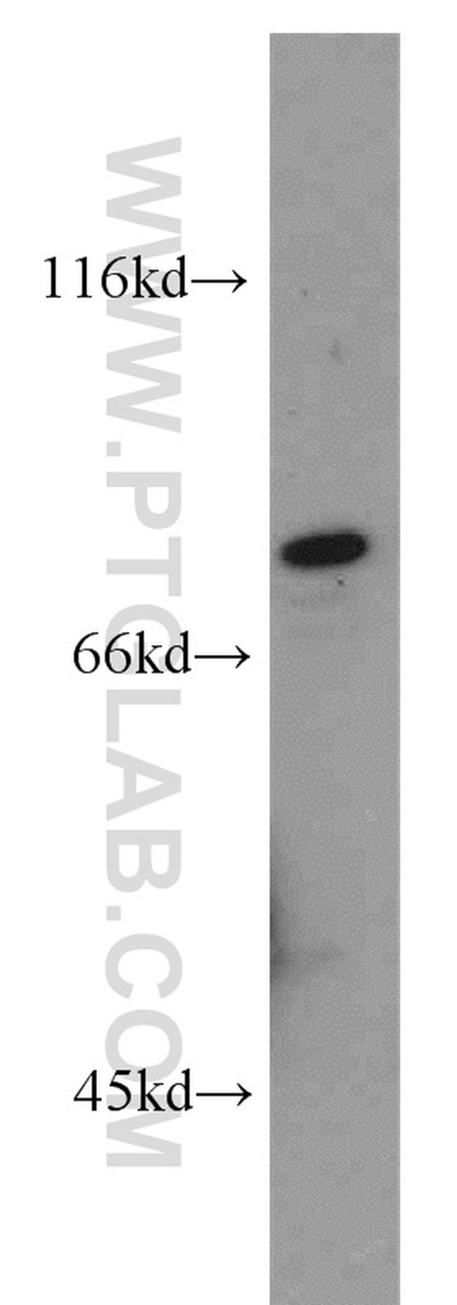 ZNF750 Antibody in Western Blot (WB)