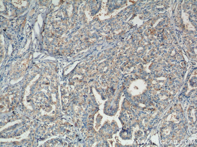 RASSF7 Antibody in Immunohistochemistry (Paraffin) (IHC (P))