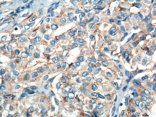 RASSF7 Antibody in Immunohistochemistry (Paraffin) (IHC (P))