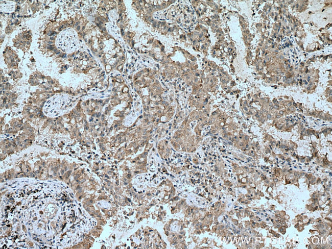 RASSF7 Antibody in Immunohistochemistry (Paraffin) (IHC (P))