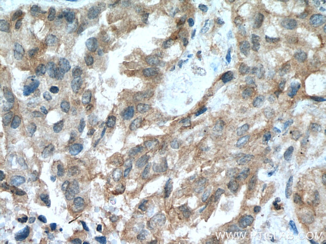 RASSF7 Antibody in Immunohistochemistry (Paraffin) (IHC (P))