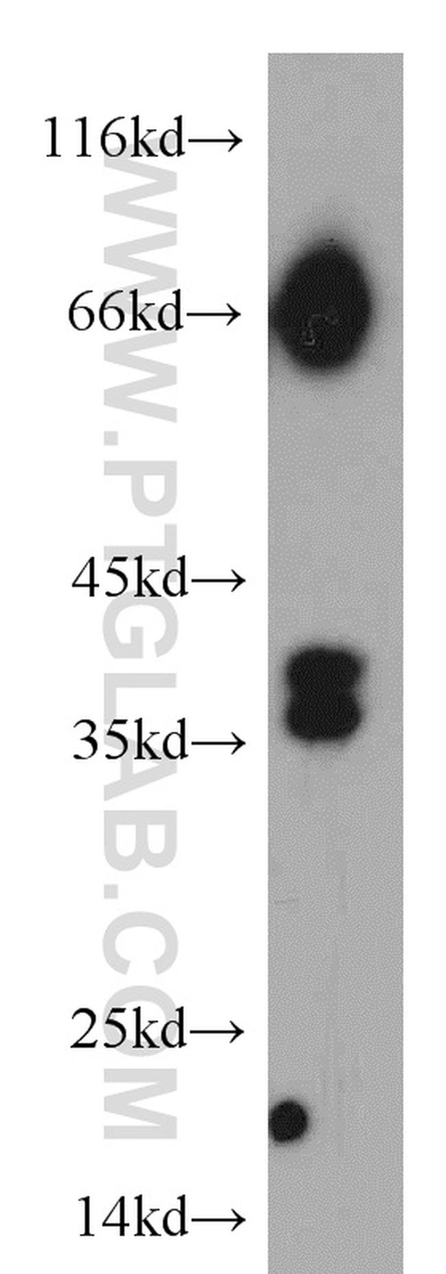 RASSF7 Antibody in Western Blot (WB)