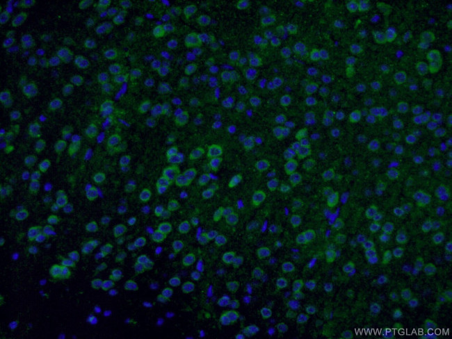 GAD65 Antibody in Immunohistochemistry (PFA fixed) (IHC (PFA))