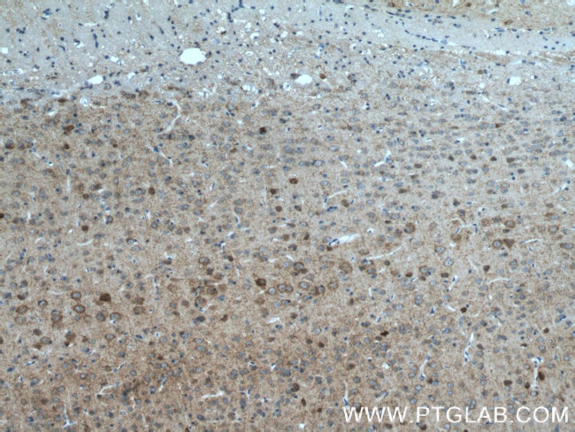 GAD65 Antibody in Immunohistochemistry (Paraffin) (IHC (P))