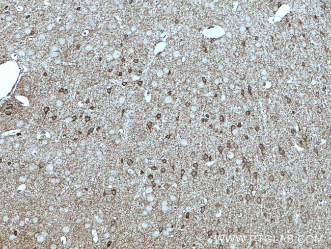 GAD65 Antibody in Immunohistochemistry (Paraffin) (IHC (P))