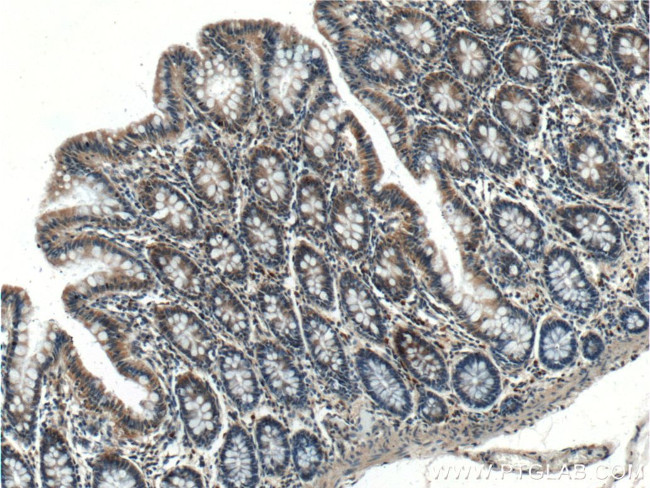 GAD65 Antibody in Immunohistochemistry (Paraffin) (IHC (P))