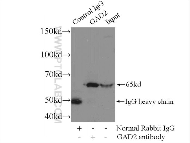 GAD65 Antibody in Immunoprecipitation (IP)