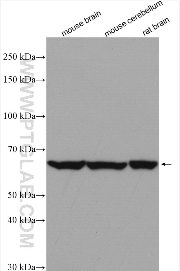 GAD65 Antibody in Western Blot (WB)