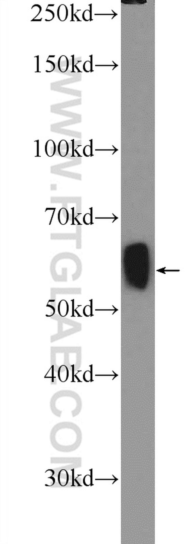 GAD65 Antibody in Western Blot (WB)