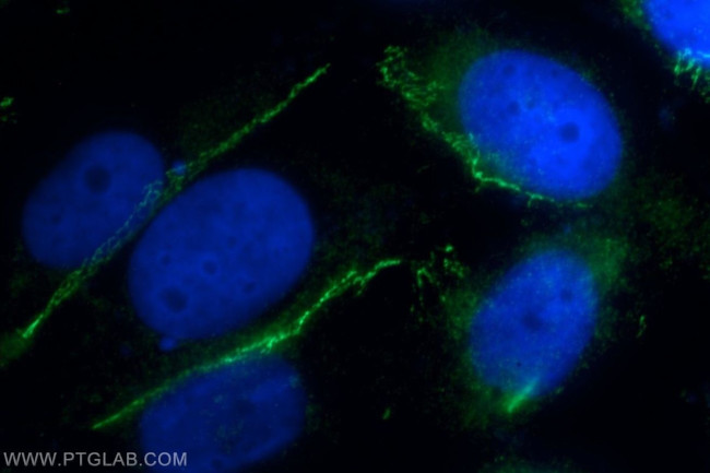 ZO-1 Antibody in Immunocytochemistry (ICC/IF)