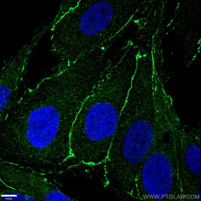 ZO-1 Antibody in Immunocytochemistry (ICC/IF)