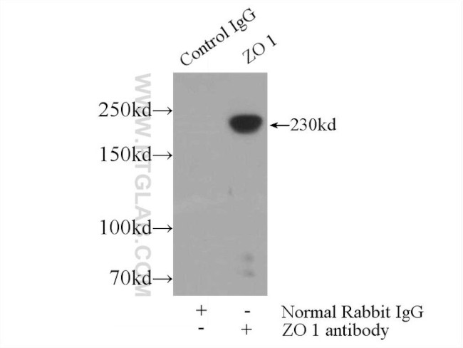 ZO-1 Antibody in Immunoprecipitation (IP)