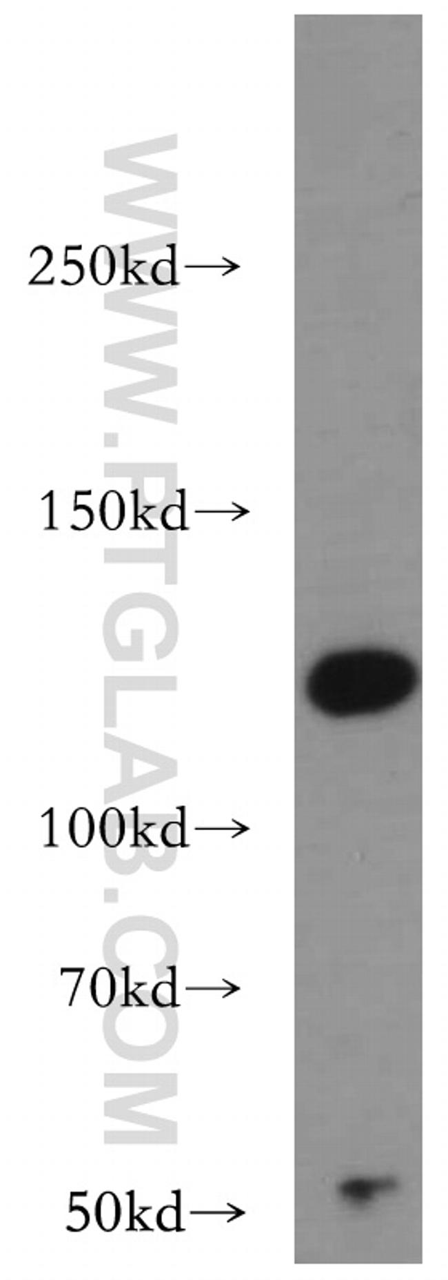 IFIH1 Antibody in Western Blot (WB)