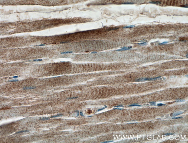 IFIH1 Antibody in Immunohistochemistry (Paraffin) (IHC (P))