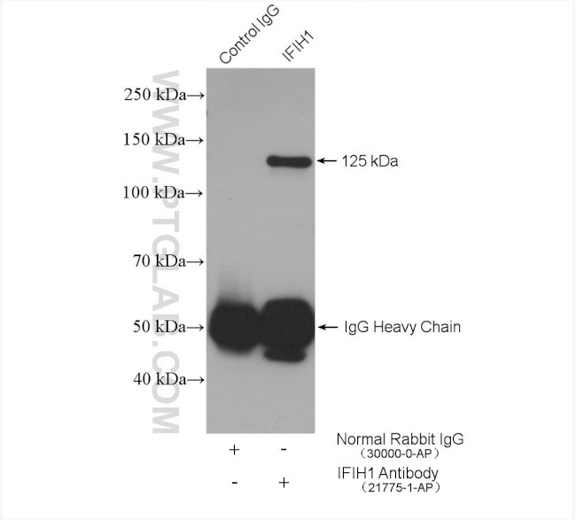 IFIH1 Antibody in Immunoprecipitation (IP)