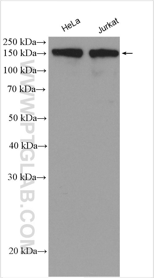 Ataxin 2 Antibody in Western Blot (WB)