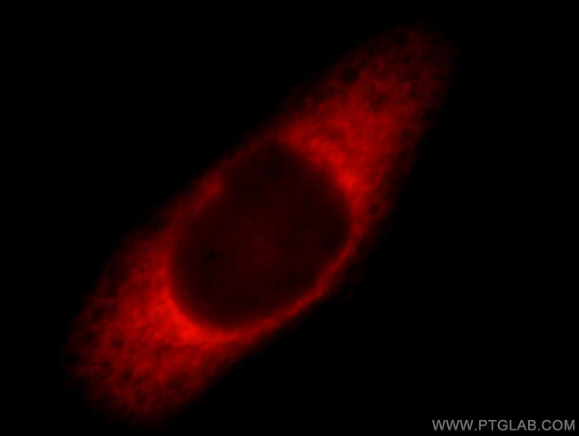 Ataxin 2 Antibody in Immunocytochemistry (ICC/IF)