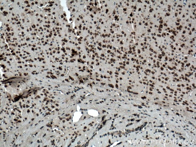 Ataxin 2 Antibody in Immunohistochemistry (Paraffin) (IHC (P))