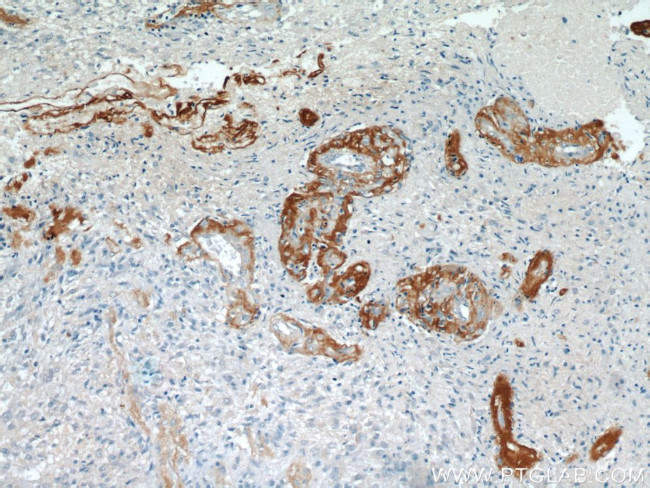 Ataxin 2 Antibody in Immunohistochemistry (Paraffin) (IHC (P))