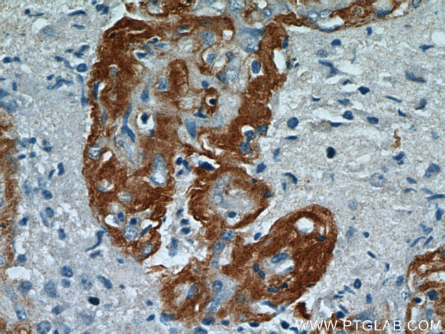 Ataxin 2 Antibody in Immunohistochemistry (Paraffin) (IHC (P))