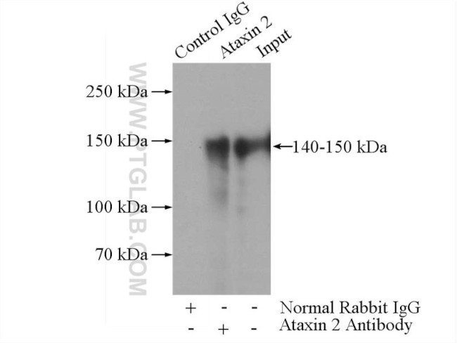 Ataxin 2 Antibody in Immunoprecipitation (IP)