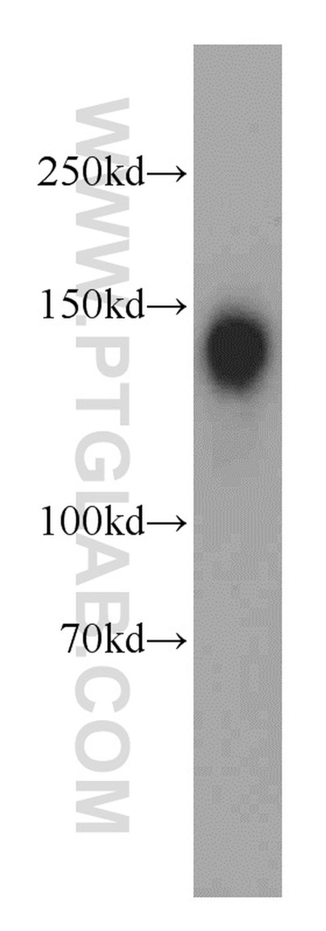 Ataxin 2 Antibody in Western Blot (WB)