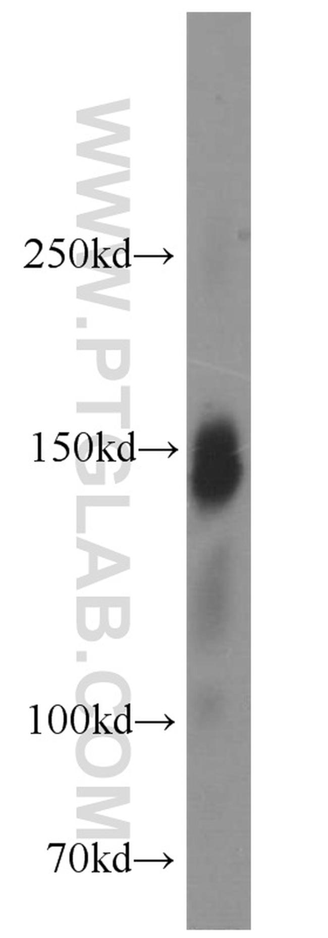 Ataxin 2 Antibody in Western Blot (WB)