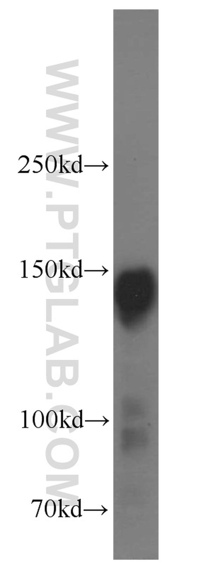 Ataxin 2 Antibody in Western Blot (WB)